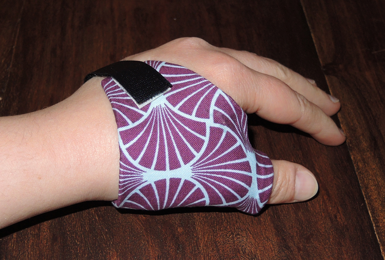 Schöner Leiden oder pimp my&nbsp;Daumenorthese